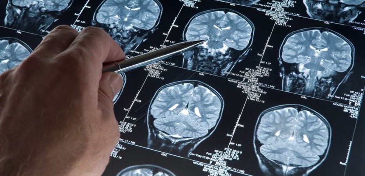 1739559558_Descubrimiento-como-las-celulas-mantienen-la-salud-del-cerebro.jpg