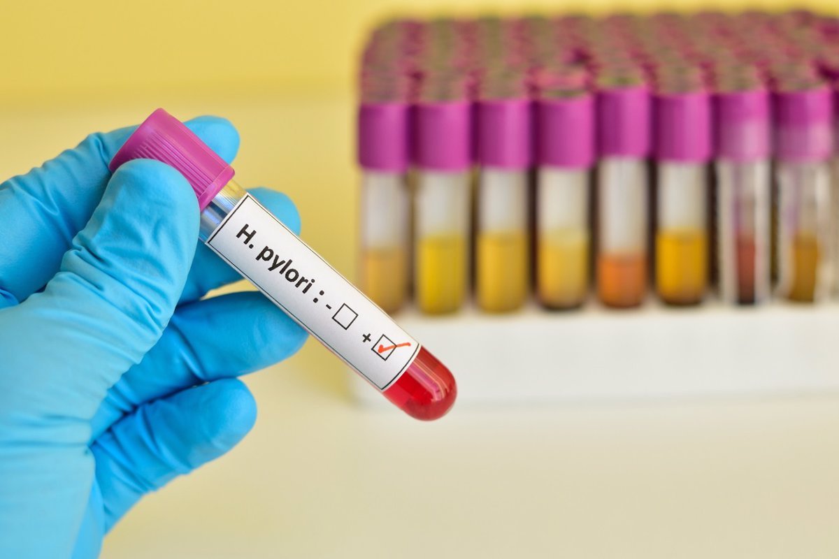 Desarrollan-biosensor-nanofotonico-para-detectar-Helicobacter-pylori-de-forma-rapida.jpg