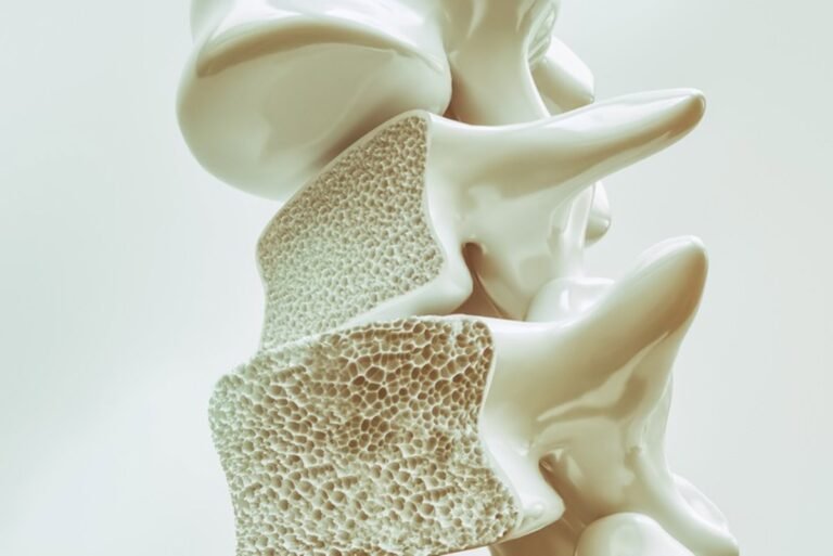 Experto-alerta-de-aumento-de-casos-de-osteoporosis-en-mujeres.jpg